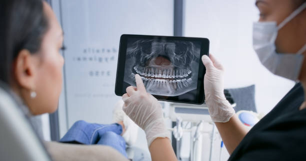 Licensed Tooth Extraction service in Sanford, NC - Smile Center Dentistry